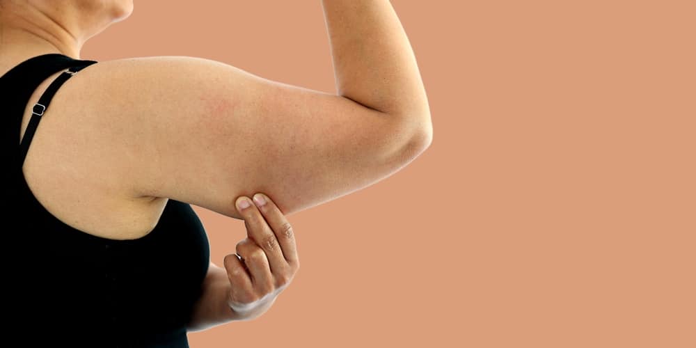 Close up of a woman pinching her underarm skin, in need of an arm lift or brachioplasty.