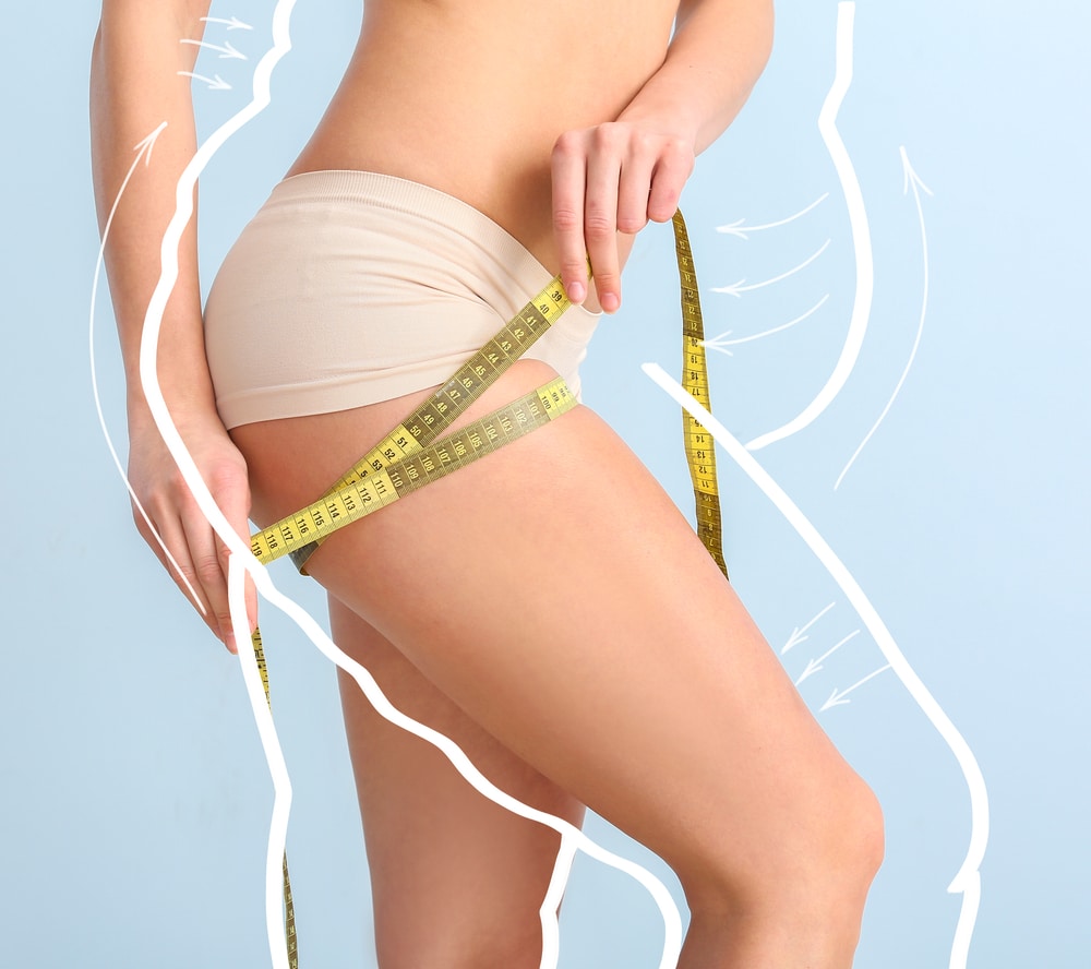 Close up of a woman with an outline of a larger body around her to signify her slimmer body after liposuction.