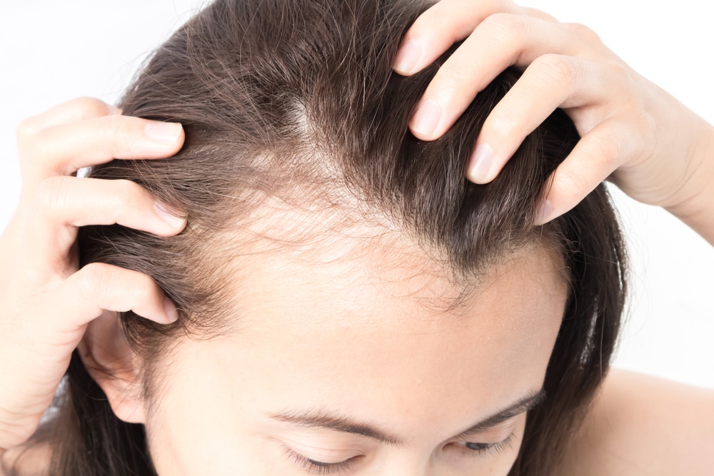 Close up of a woman touching her hair to show how it's thinning and in need of hair restoration treatment.