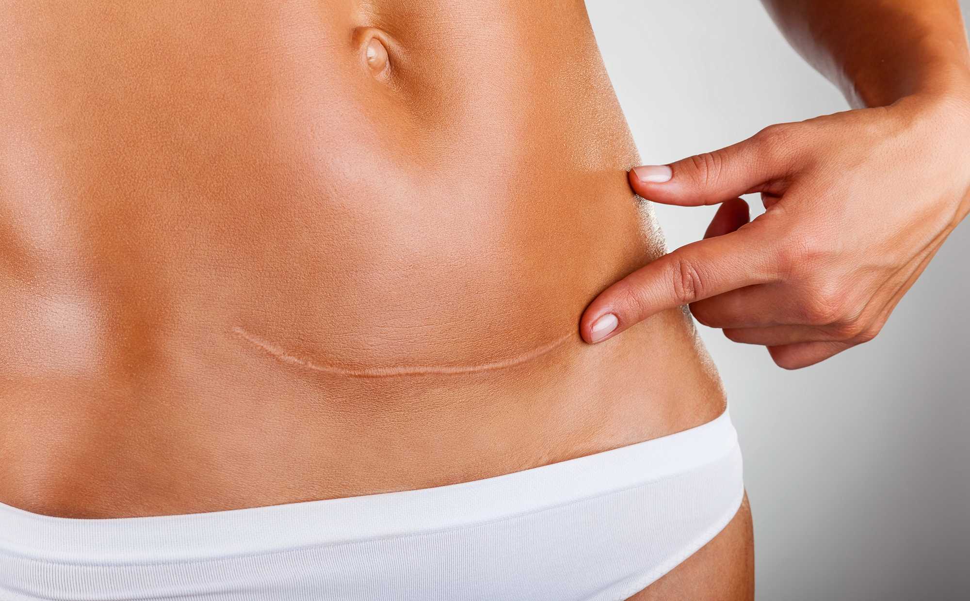 Abdomen with scar and fingers.