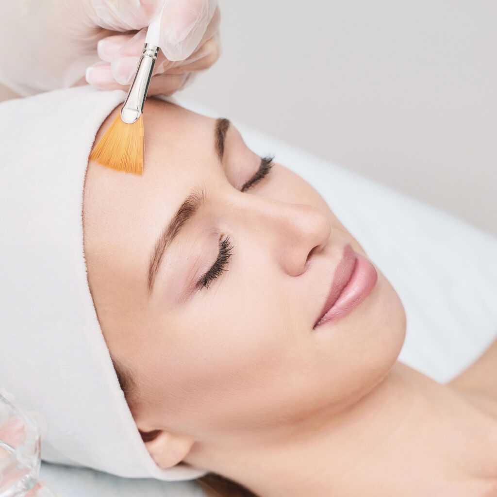 Facial chemical peel application